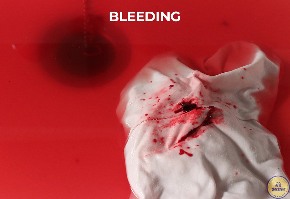 Bleeding