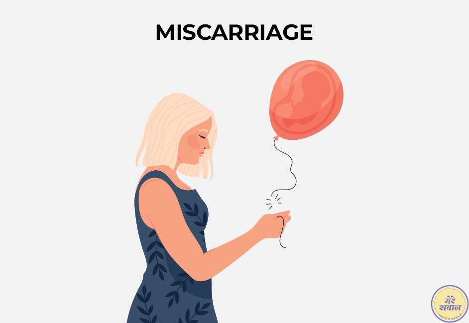 Miscarriage