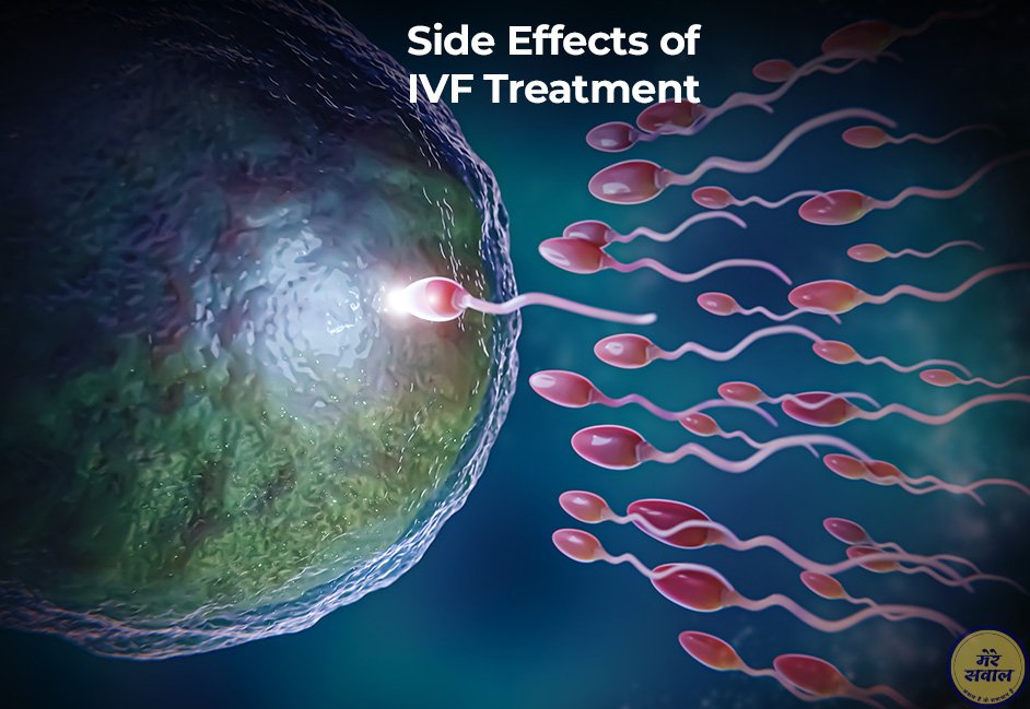 Side Effects of IVF Treatment