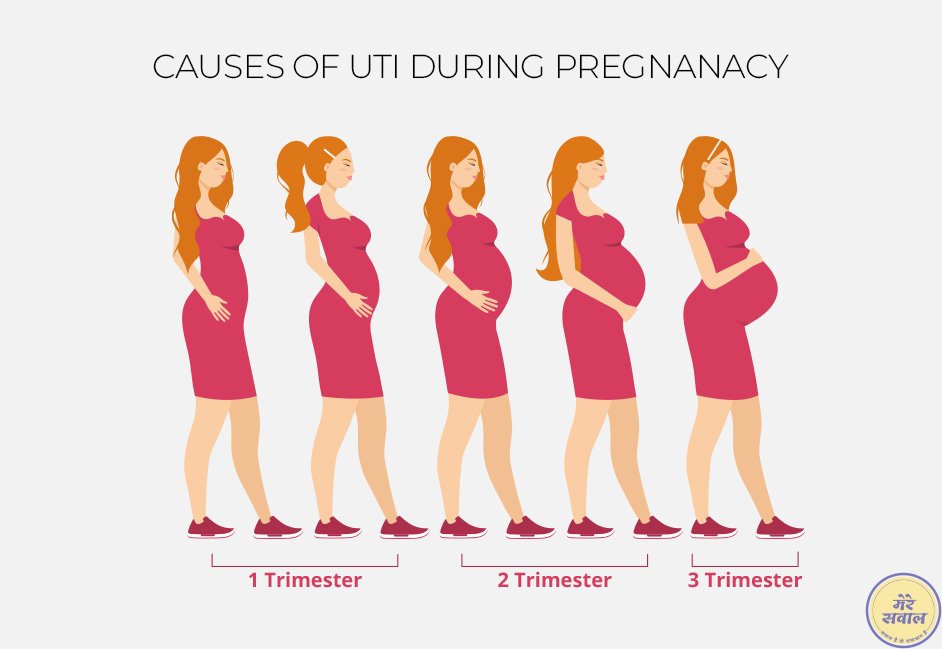 Causes-of-uti-during-pregnancy